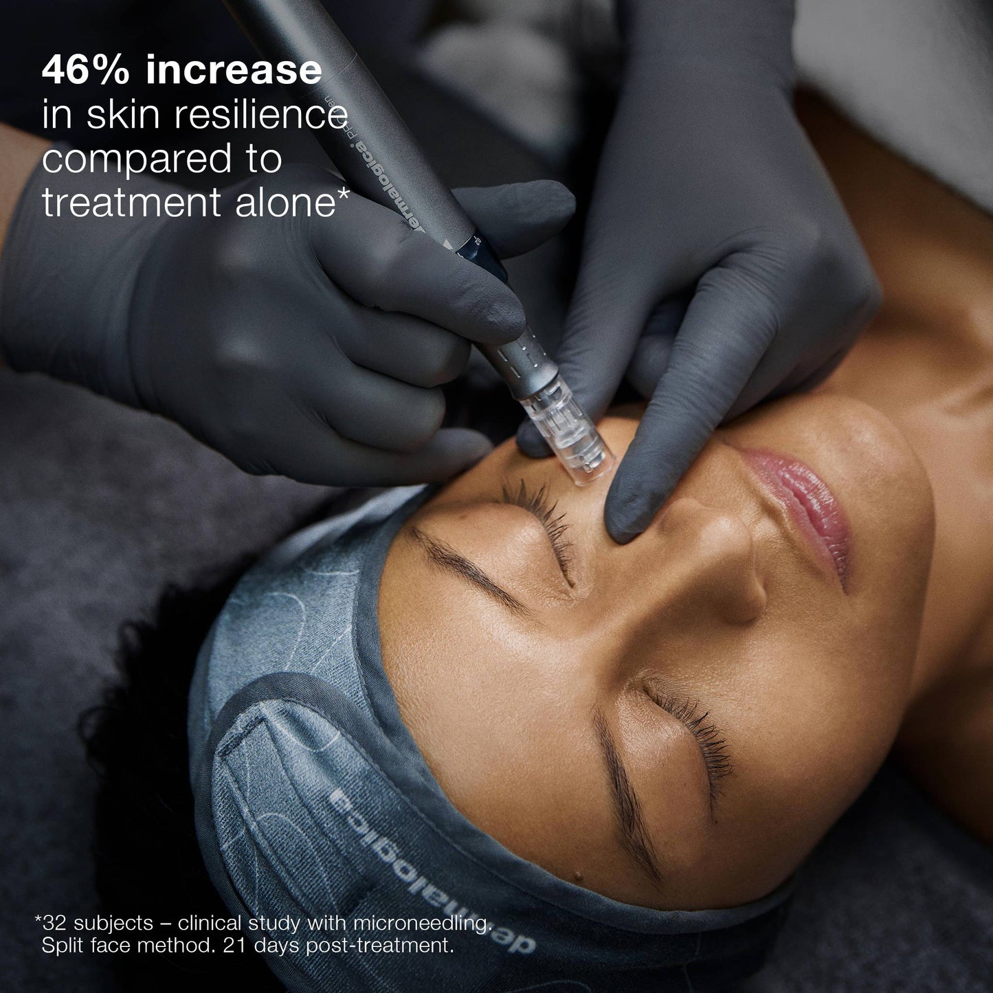 Person receiving microneedling treatment on face with text about skin resilience increase.